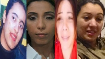 شاهد فنانات مغربيات شهيرات قبل و بعد عمليات التجميل